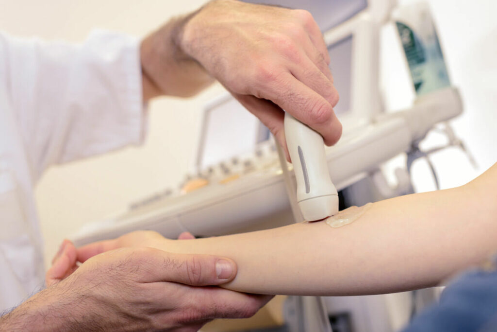 Manipolo per ultrasuoni applicato su un paziente durate una seduta di fisioterapia
